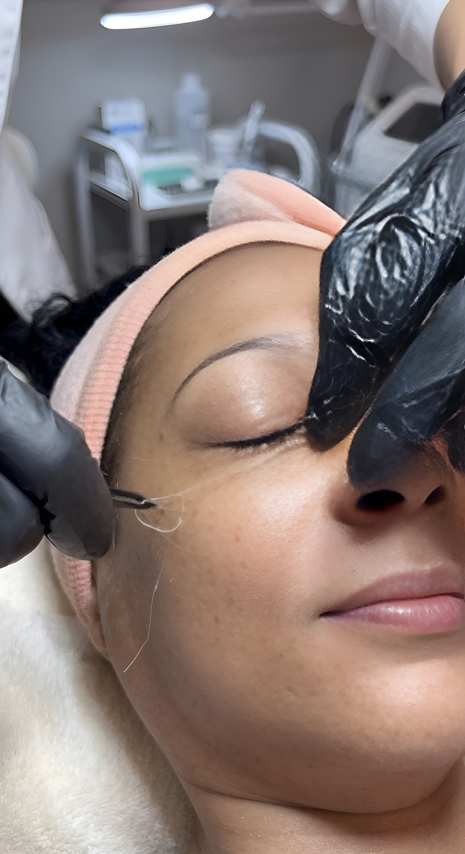 Collagen Thread Facial